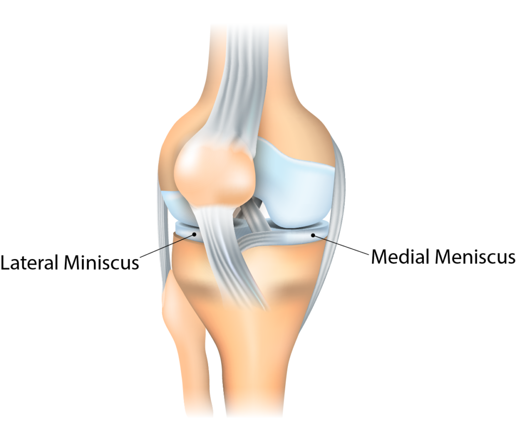 Anatomical graphic of knee showing meniscus.