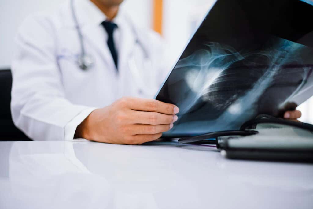 A doctor in a white coat examines an X-ray image at a desk.